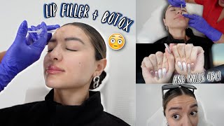 I GOT MY LIPS DONE!! and botox ... *makeover vlog*
