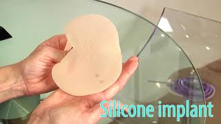 Saline vs. Silicone Debate