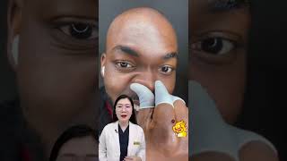 Review - How to prevent sebum filaments and blackheads on the nose #thsbsphuongquy #review #react...