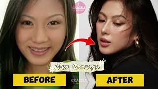 PINOY CELEBRITIES NA NAGPARETOKE / NAGPA-ENHANCE NG ILONG (BEFORE & AFTER)