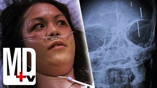 Her parents inserted PINS IN HER BRAIN as an infant! | House M.D. | MD TV