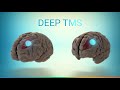 Introducing Deep TMS (dTMS)