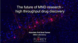 New treatments for MND: The future of high throughput drug screening