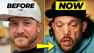 Rick Ness Looks UNRECOGNIZABLE! Rick Ness’ Nose SHOCKS Fans! | GOLD RUSH