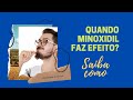 EM QUANTO TEMPO O MINOXIDIL FAZ EFEITO?