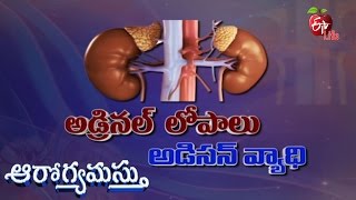 Aarogyamastu - Conn's Syndrome - 14th March 2016 - ఆరోగ్యమస్తు - Full Episode