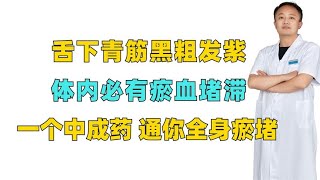 舌下青筋黑粗发紫？体内必有瘀血堵滞，一个中成药，通你全身瘀堵