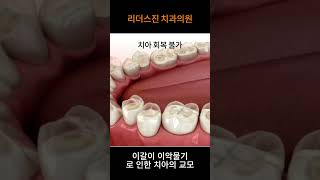 [리더스진 치과의원] 치아의 손상 ASMRㅣ이갈이 이악물기ㅣ회복되지 않는 시림증상과 통증 유발!