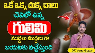 Ear Wax Tips - ఒకే ఒక్క చుక్క చెవిలో గులిమి మొత్తం బయటకు వచ్చేస్తుంది || ManamTV Hyderabad Health