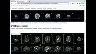 qsiprep report