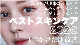 【ベストスキンケア2020】肌荒れ赤み肌の私が変われた最強スキンケアを厳選【プチプラ・デパコス】