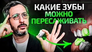 Пересадка собственных зубов – зубы мудрости вместо семерок