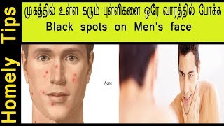 ஆண்களுக்கு  முகத்தில் உள்ள கரும் புள்ளிகளை ஒரே வாரத்தில் போக்க|Black spots on Men's face in Tamil