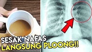 Cara Mengatasi Sesak Nafas