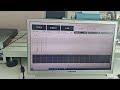 brake dynamo test 2