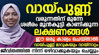 വായ്പുണ്ണ് വരുന്നതിന്റെ മുന്നേ ശരീരം മുൻകൂട്ടി കാണിച്ചുതരുന്ന ലക്ഷണങ്ങൾ ഇതാണ്