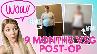 Weight Loss & Loose Skin: 9-Months VSG Post-Op Update
