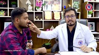 সাইনাসের সমস্যার আধুনিক চিকিৎসা | FESS | Functional Endoscopic Sinus Surgery | Dr Bashudeb Kumar