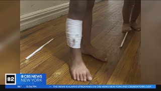 Young brothers, ages 3 and 6, recovering after Bronx park shooting