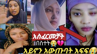 በህክምና ስተት አይኖን አወጡባት/ ጎደኛዋን/አምና ጉድ ሠራቻት😢!#like #duet #comedy #live