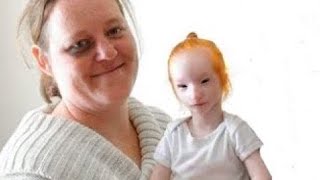 She Adopts A Girl That Nobody Wants. 19 Years Later, She Looks Totally Different