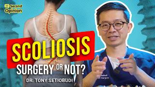 🔴 DO YOU NEED SCOLIOSIS SURGERY? 🔴 | DR TONY SETIOBUDI
