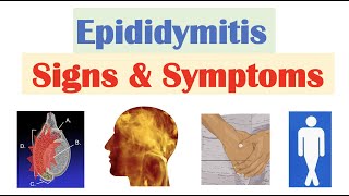 Epididymitis (Scrotal Pain) Signs & Symptoms | & Why They Occur