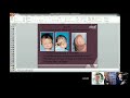 subodh raju md surgical options in craniosynostosis