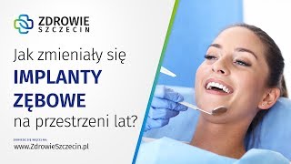 Jak zmieniały się implanty zębowe na przestrzeni lat? - Zdrowie Szczecin