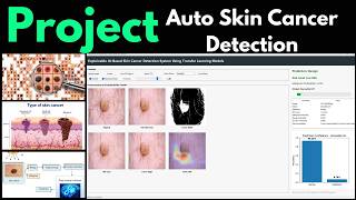 Best Skin Cancer Datasets for Machine Learning & CNN Projects