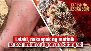 Lalaki, nakaapak ng matinik na sea urchin o tuyom sa Batangas! | Kapuso Mo, Jessica Soho