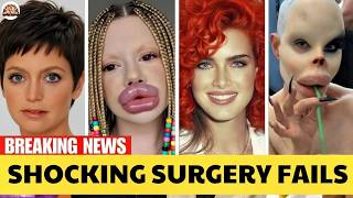 25 Celebrity Cosmetic Surgery Disasters That Shocked Fans! 😱 (Then and Now 2026)