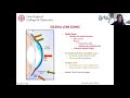 Scleral Lens Assessment and Fitting