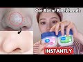 How I INSTANTLY Removed My Blackheads with VASELINE