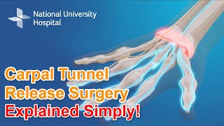 Carpal Tunnel Release Surgery - Explained