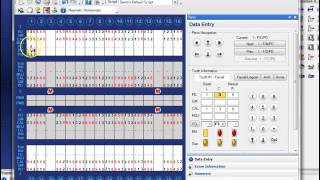 Dentrix step by step - Perio charting
