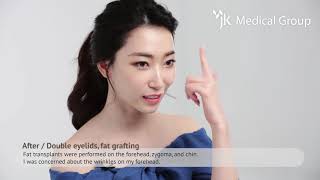 REAL B\u0026A JK Plastic Surgery Double Eyelid and Fat Grafting, Paik, Hye Won Plastic Surgeon