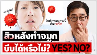 สิวที่เกิดหลังจากทำจมูก! สิวเม็ดใหญ่สามารถส่งผลต่อจมูกที่ทำมาได้? | บีเดอะนิว