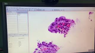 QuPath annotation