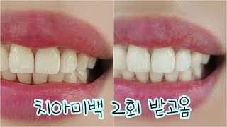 내생애 첫 치아미백 후기 2회 받고옴 Tooth whitening