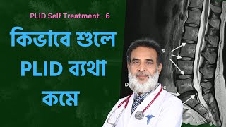 নিজে নিজে PLID চিকিৎসা-৬  | কিভাবে শুলে PLID কমে | How To Lye For PLID | Doctor Shah Alam