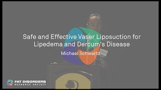 Safe and Effective Vaser Liposuction for Lipedema and Dercum's Disease