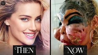 10 Famous Celebrities Unrecognizable After Plastic Surgery Gone Wrong | Then and Now 2026