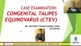 Congenital Talipes Equino Varus | Clinical Orthopaedics | Dr.Prateek Joshi M.S.,| MEDUSANE