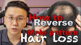How to Reverse Male Pattern Baldness - Hair Loss in Men