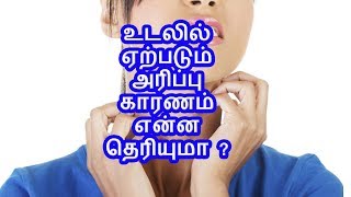 உடலில் ஏற்படும் அரிப்பு காரணம் என்ன தெரியுமா ?