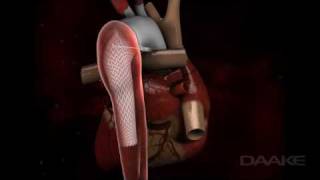 ANIMATION DETAILS GROUNDBREAKING SURGERY