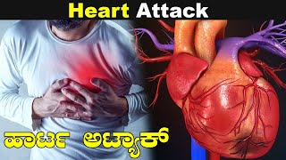 Heart attack symptoms in kannada | ಹೃದಯಾಘಾತದ ಲಕ್ಷಣಗಳು - Symptoms of heart attack in kannada