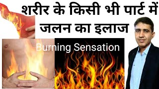 Burning | जलन होना | Burning Sensation Causes and Treatment | Burning Sensation Homeopathy Medicine