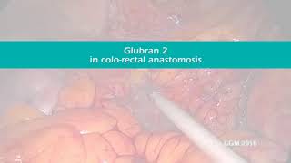 Glubran2 in colo rectal anastomosis